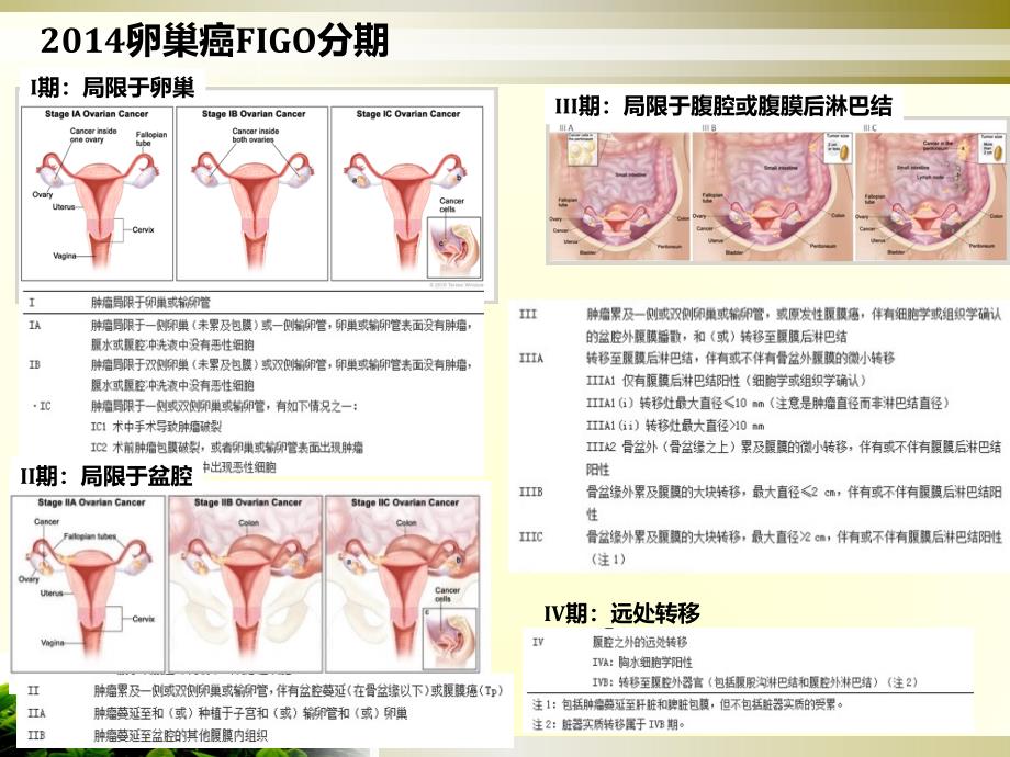 妇科肿瘤课件_第3页