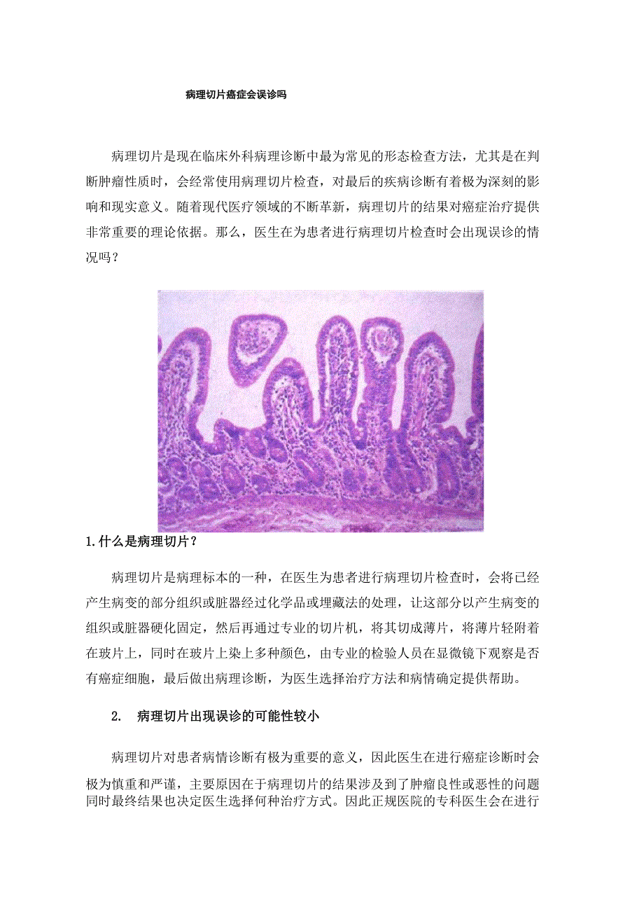 病理切片癌症会误诊吗_第1页