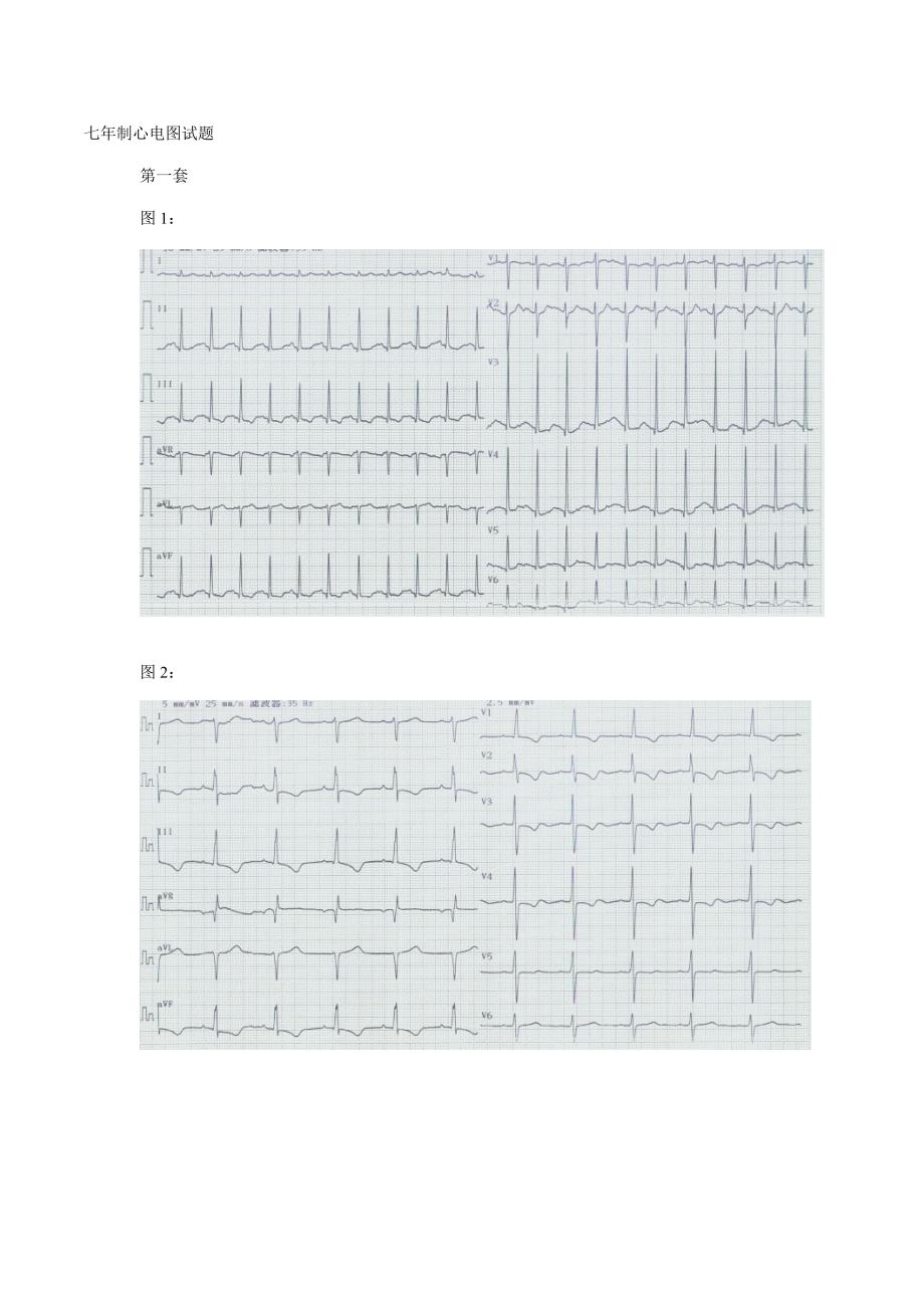 心电图试题及重点标准答案_第1页
