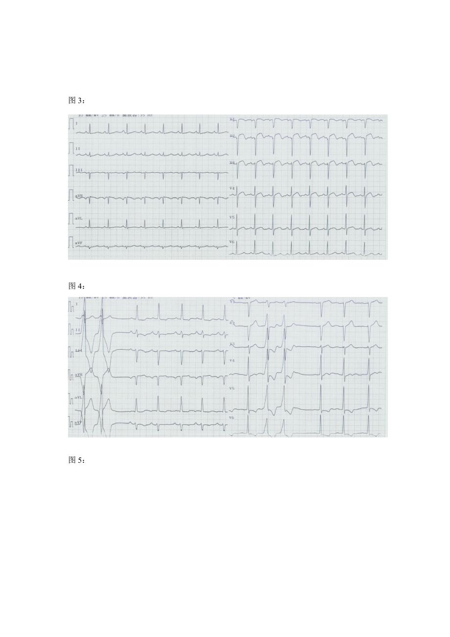 心电图试题及重点标准答案_第2页