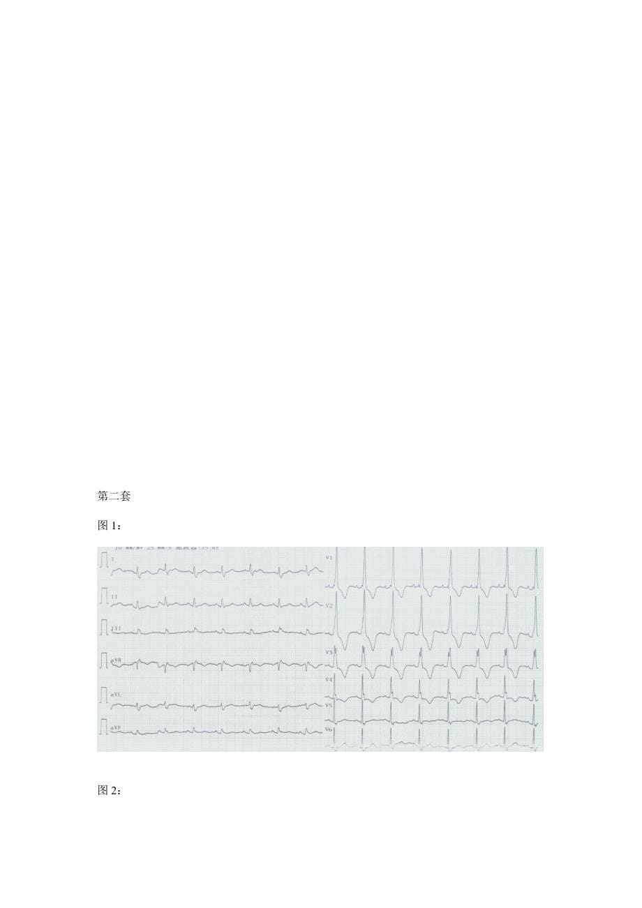 心电图试题及重点标准答案_第5页