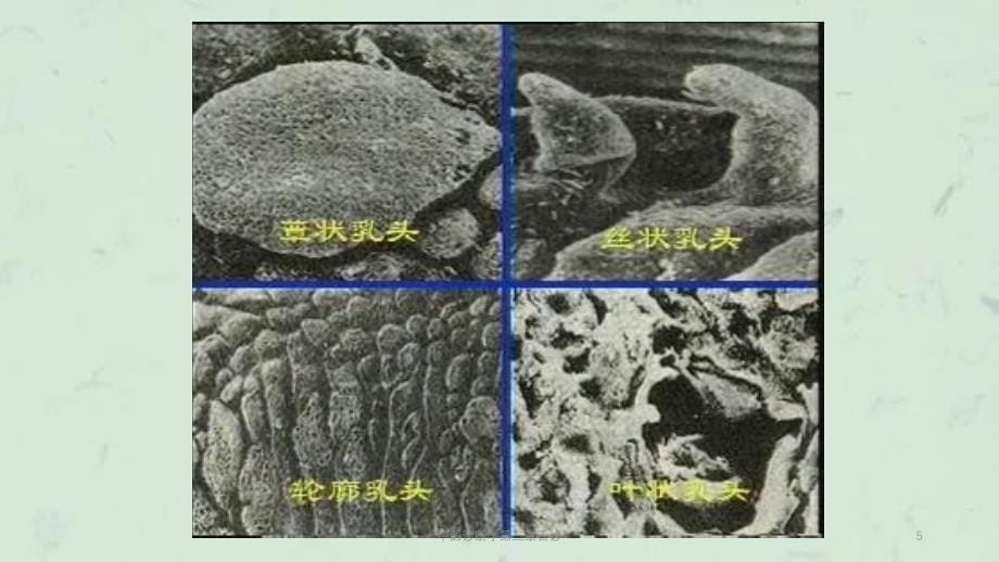 中医诊断学第三章舌诊课件_第5页