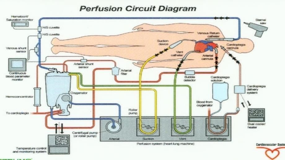 体外循环与心肌保护_第5页