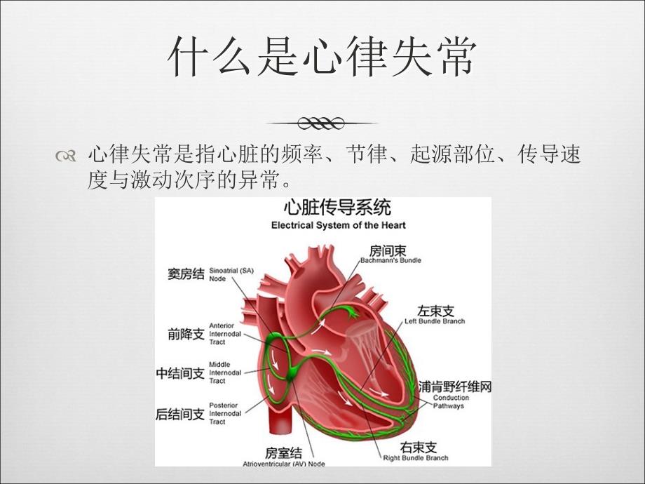 儿童常见心律失常的诊治ppt课件-PPT课件_第2页