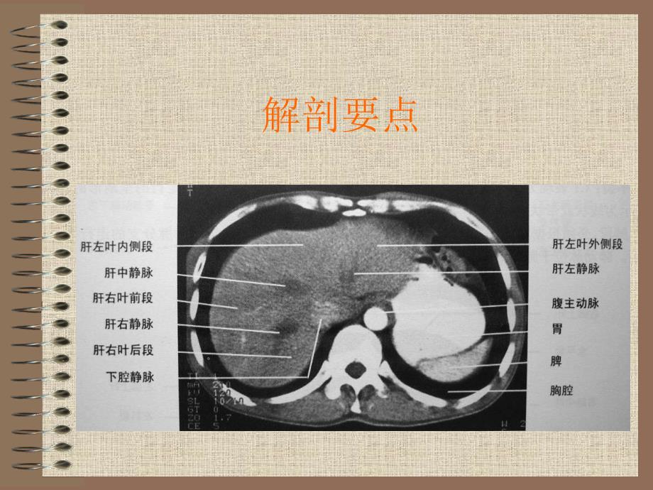 上腹部常见疾病ＣＴ诊断（肝 胆）_第4页