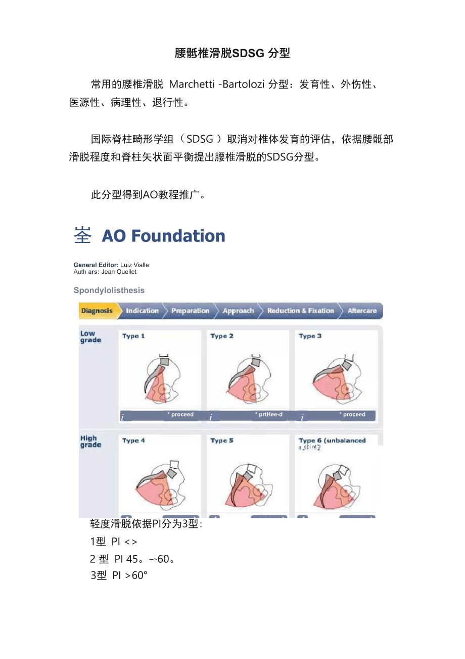 腰骶椎滑脱SDSG分型_第1页