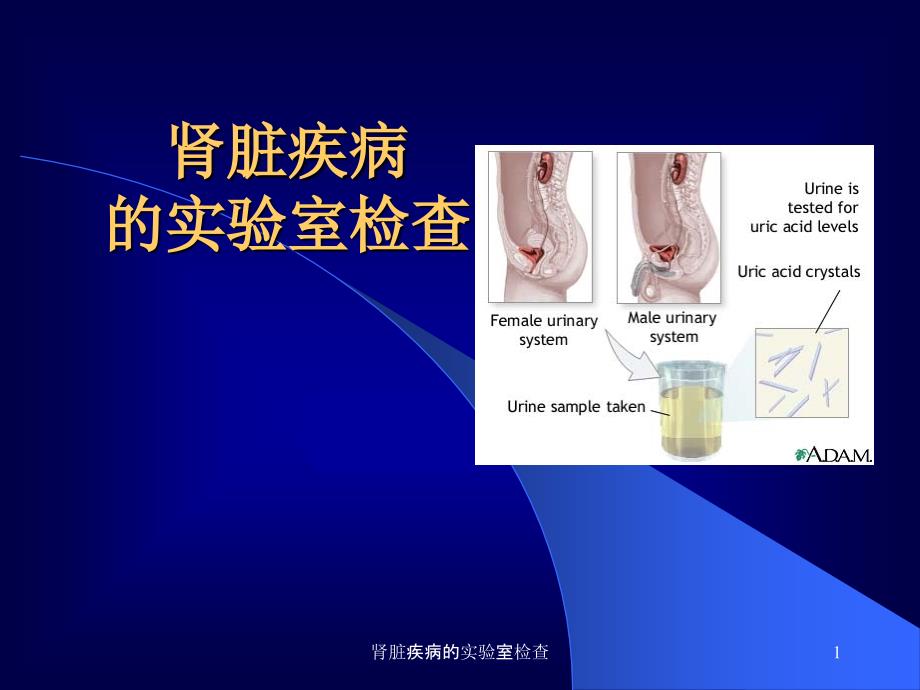 肾脏疾病的实验室检查课件_第1页