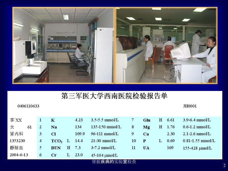 肾脏疾病的实验室检查课件_第2页