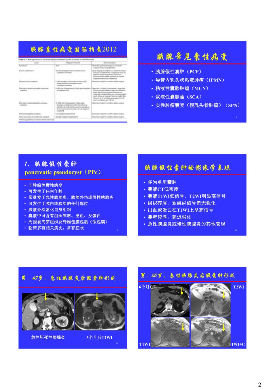 胰腺常见囊性病变的CT-MRI诊断杨正汉.pdf_第2页