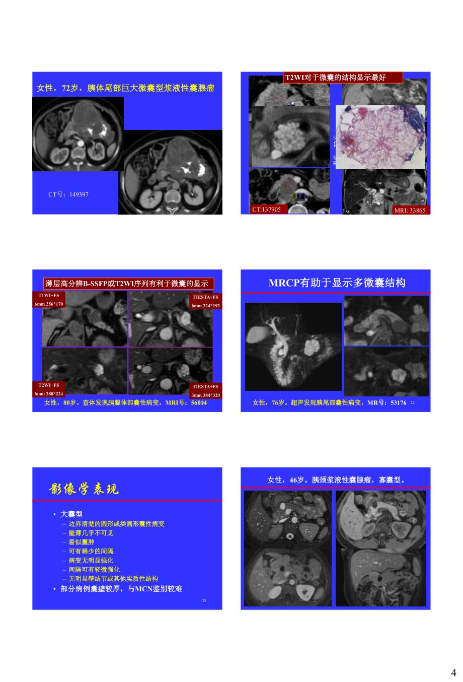 胰腺常见囊性病变的CT-MRI诊断杨正汉.pdf_第4页