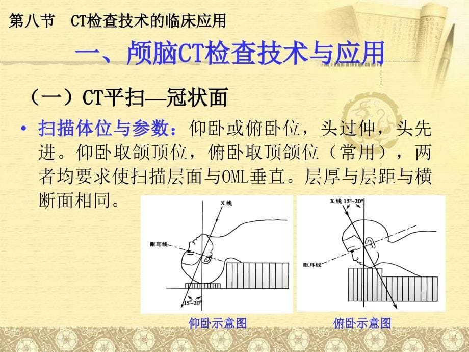 CT检查技术的临床应用PPT参考课件_第5页