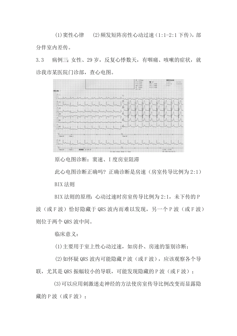 结合病例,谈谈特征性心电图波形的临床意义.docx_第4页