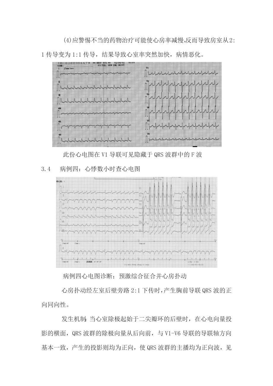 结合病例,谈谈特征性心电图波形的临床意义.docx_第5页