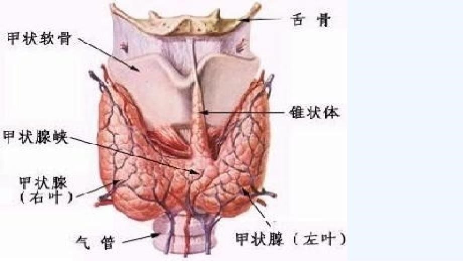 甲状腺肿的护理查房课件_第5页