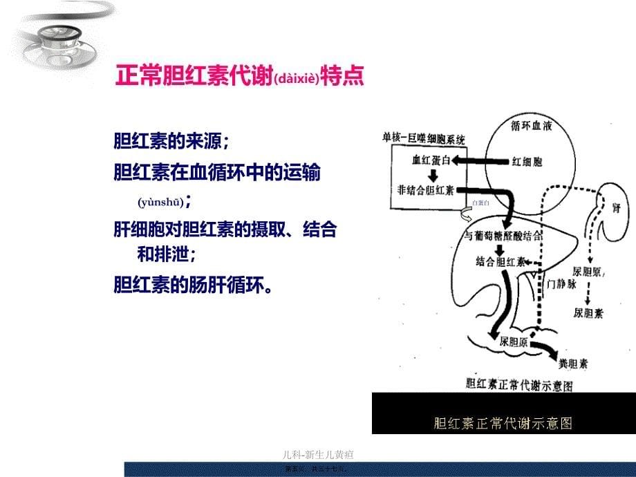 儿科新生儿黄疸课件_第5页