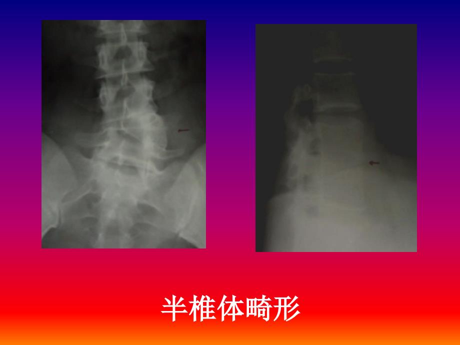 骨关节系统影象诊断_第3页