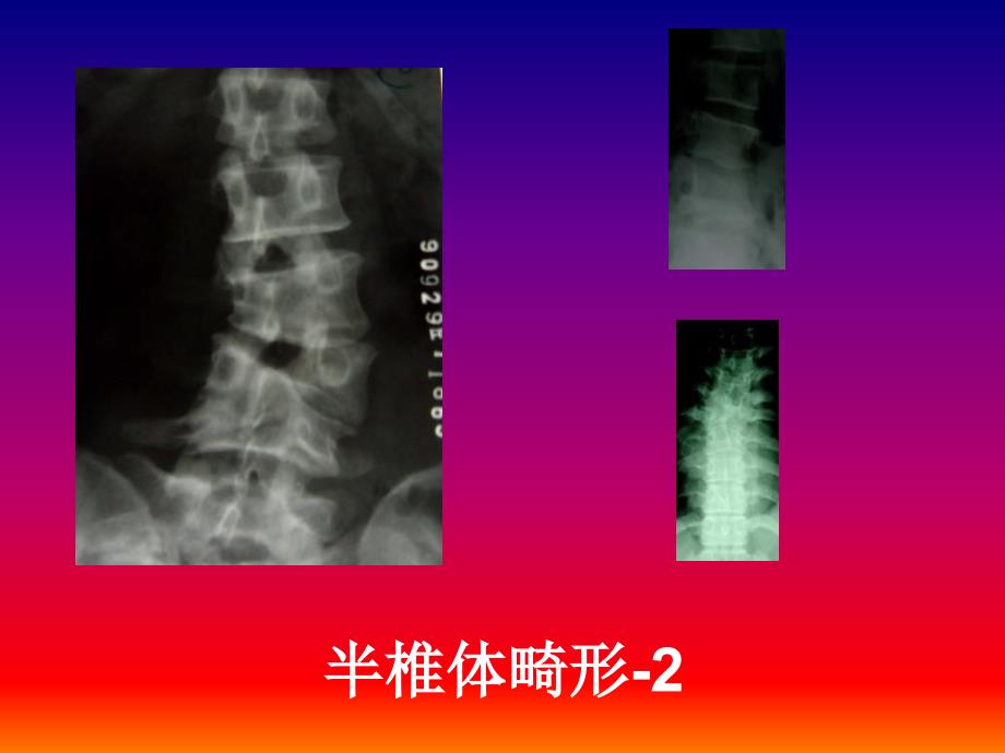 骨关节系统影象诊断_第4页