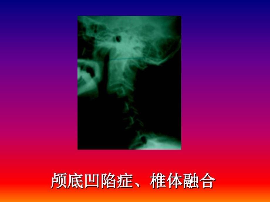 骨关节系统影象诊断_第5页