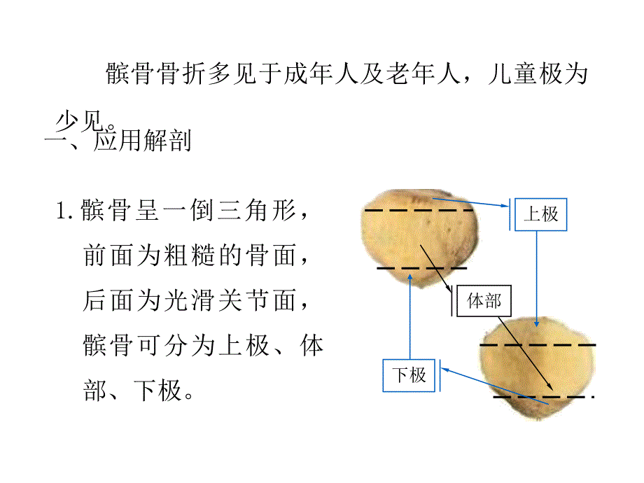 髌骨骨折医学PPT课件_第4页