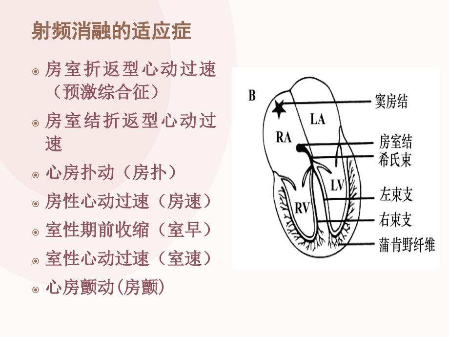 心脏射频消融术的护理_第3页