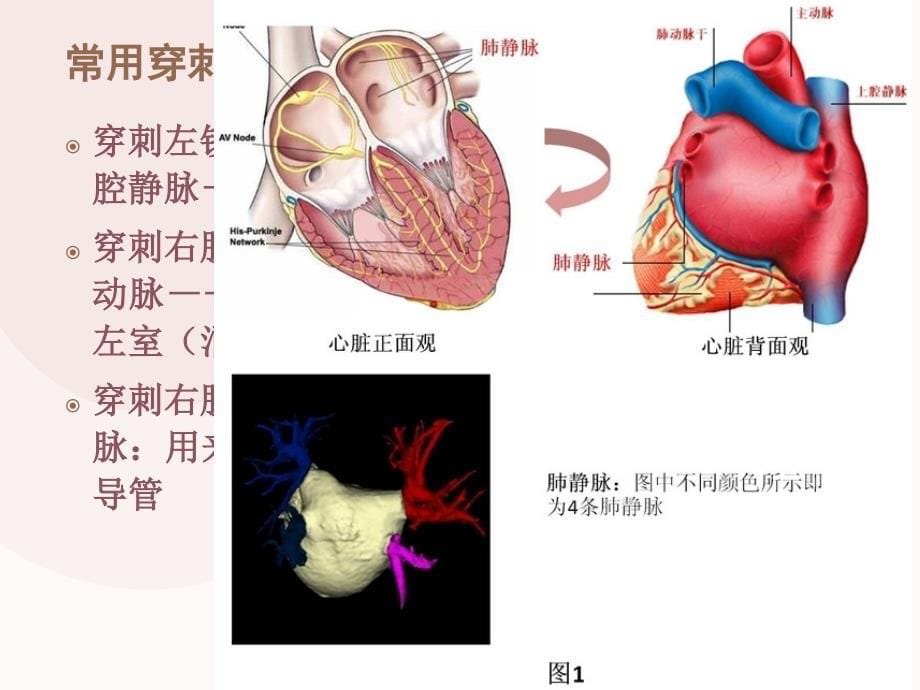 心脏射频消融术的护理_第5页