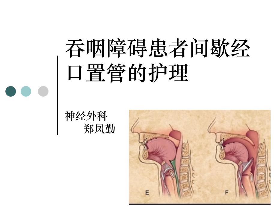 卒中后营养及吞咽困难的管理课件_第1页