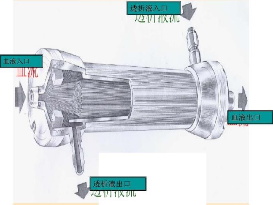 最新常见透析器介绍PPT课件_第4页