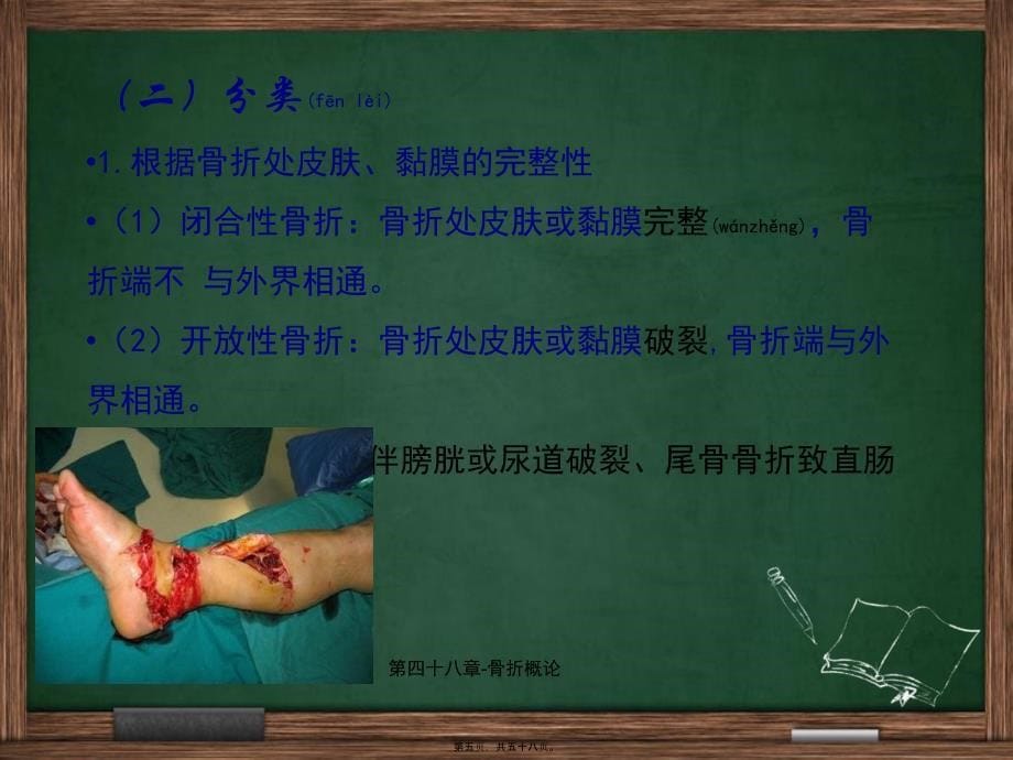 第四十八章骨折概论课件_第5页