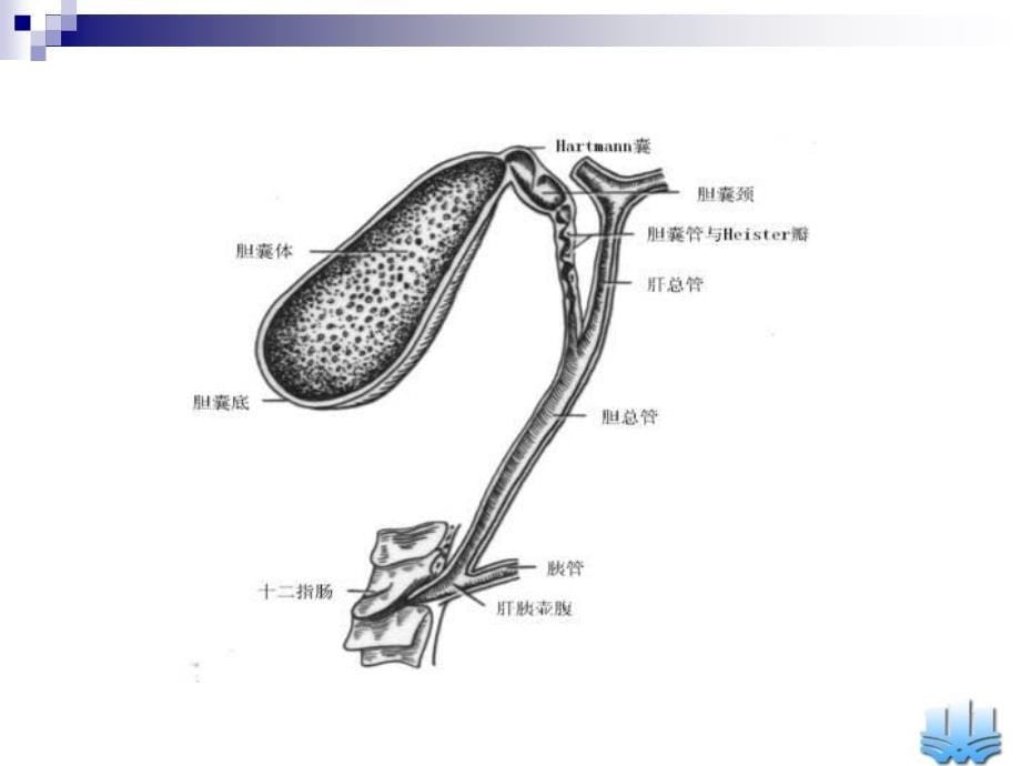 胆道疾病张翀教学ppt_第5页