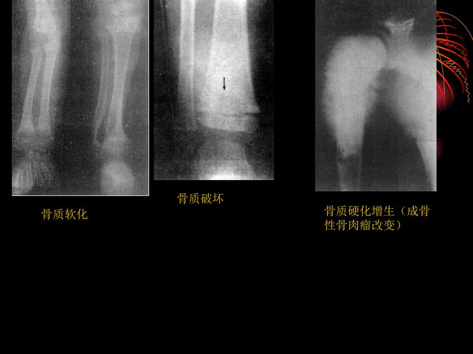 普通x线骨骼系统影像表现_第4页