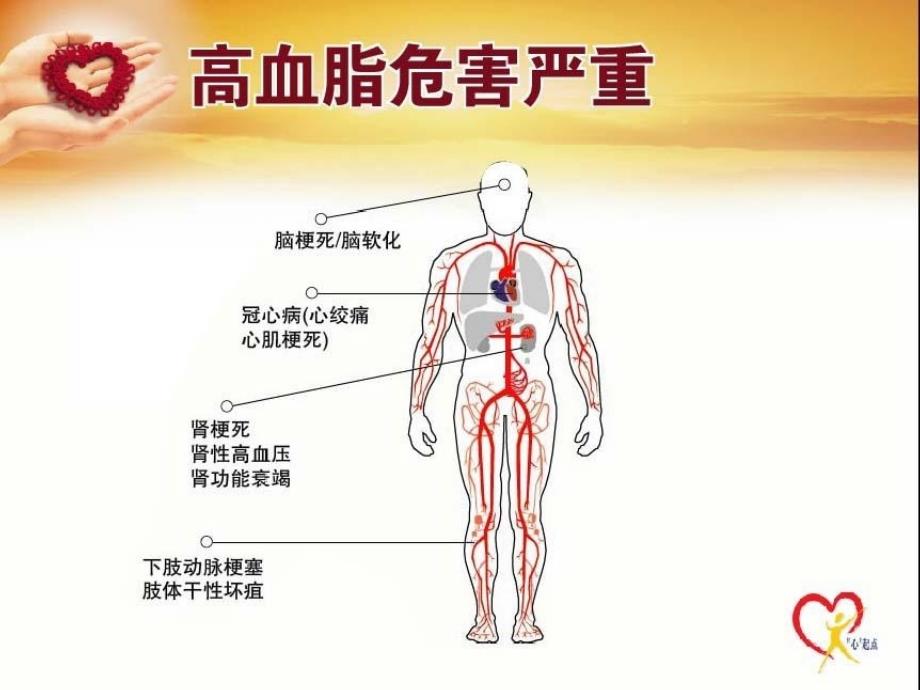 高血脂患者宣教课件_第3页