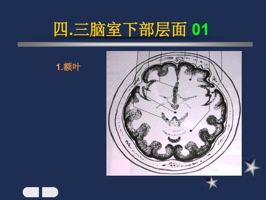 脑室下部层面解剖要点_第1页