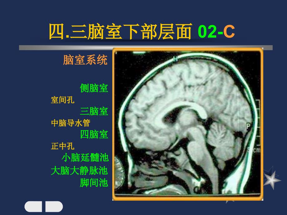 脑室下部层面解剖要点_第4页