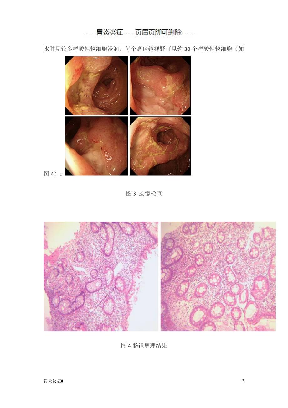 嗜酸性粒细胞胃肠炎#炎症_第3页