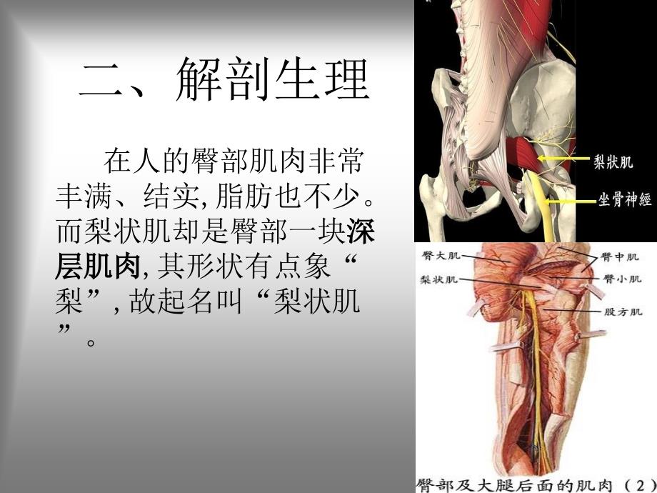 梨状肌综合征课件_第3页