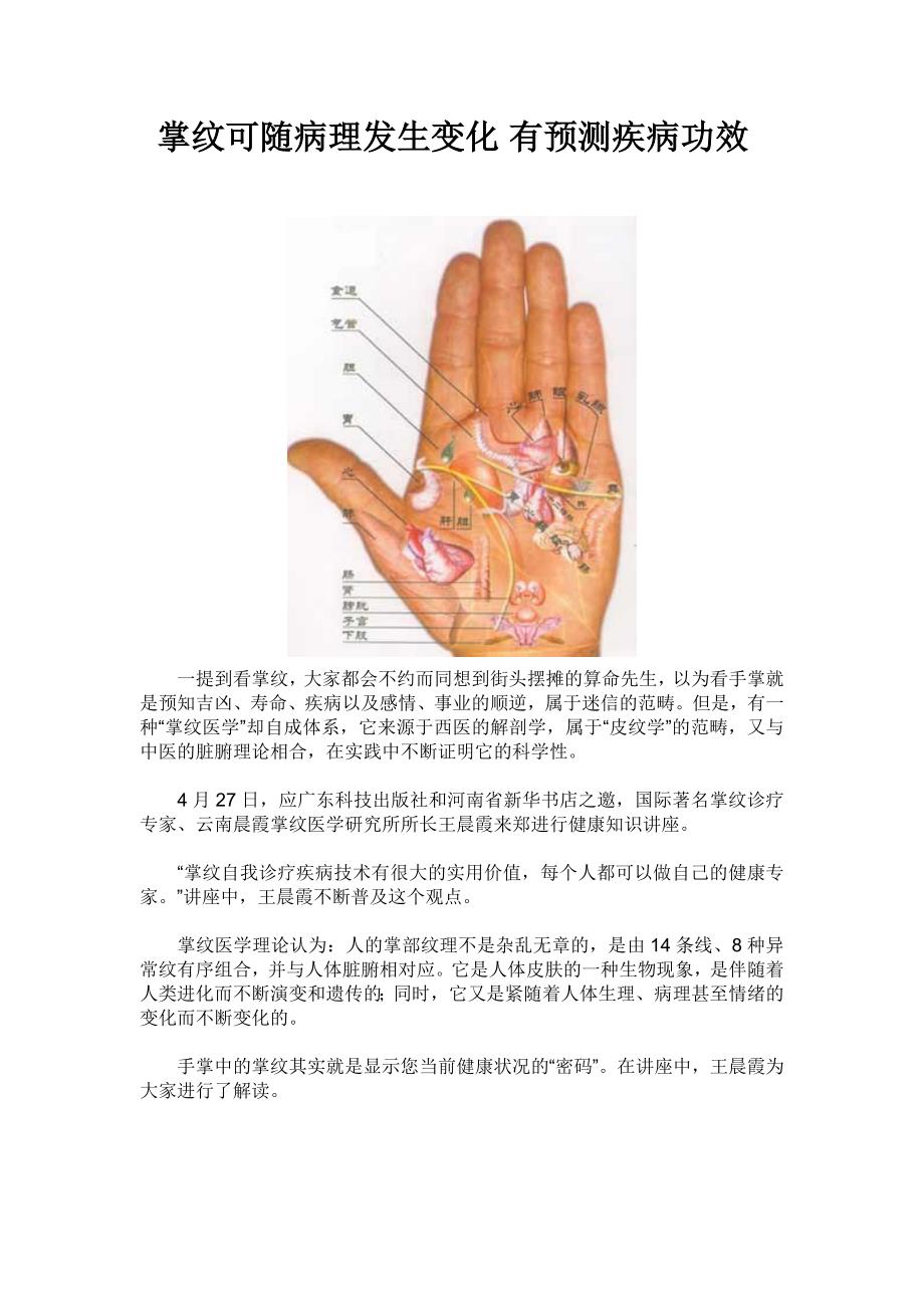 掌纹可随病理发生变化 有预测疾病功效_第1页
