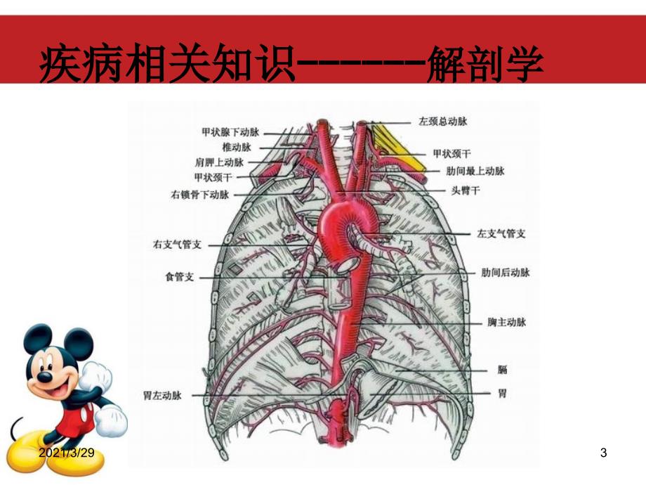 主动脉夹层护理查房.PPT_第3页