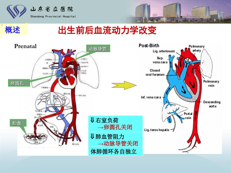 最新新生儿先心病诊治进展ppt课件PPT文档_第2页