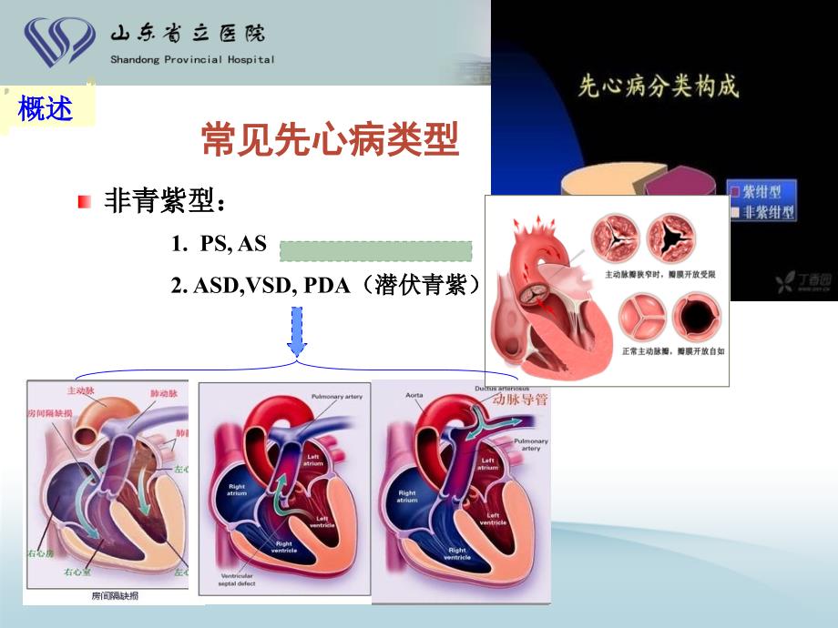 最新新生儿先心病诊治进展ppt课件PPT文档_第3页