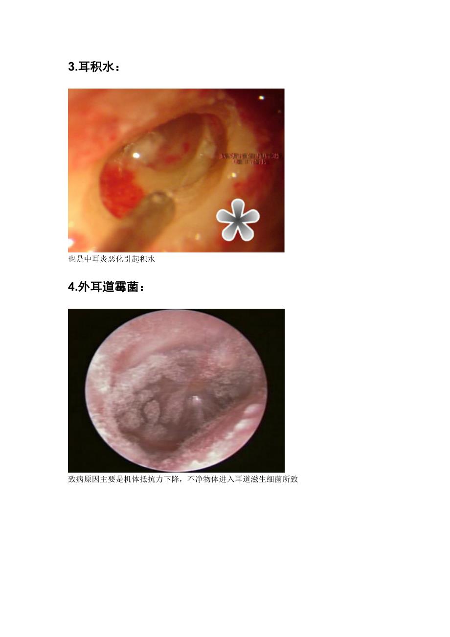 常见耳病治疗项目和操作.doc_第2页