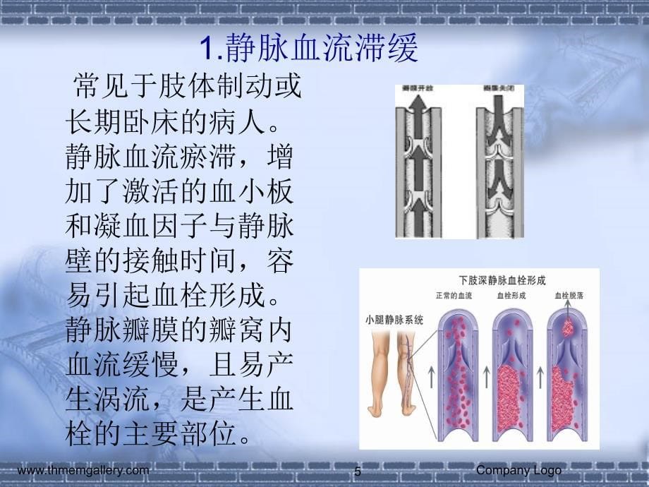 下肢深静脉血栓的预防与护理_第5页