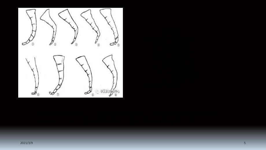 如何诊断骶尾骨骨折PPT课件_第5页