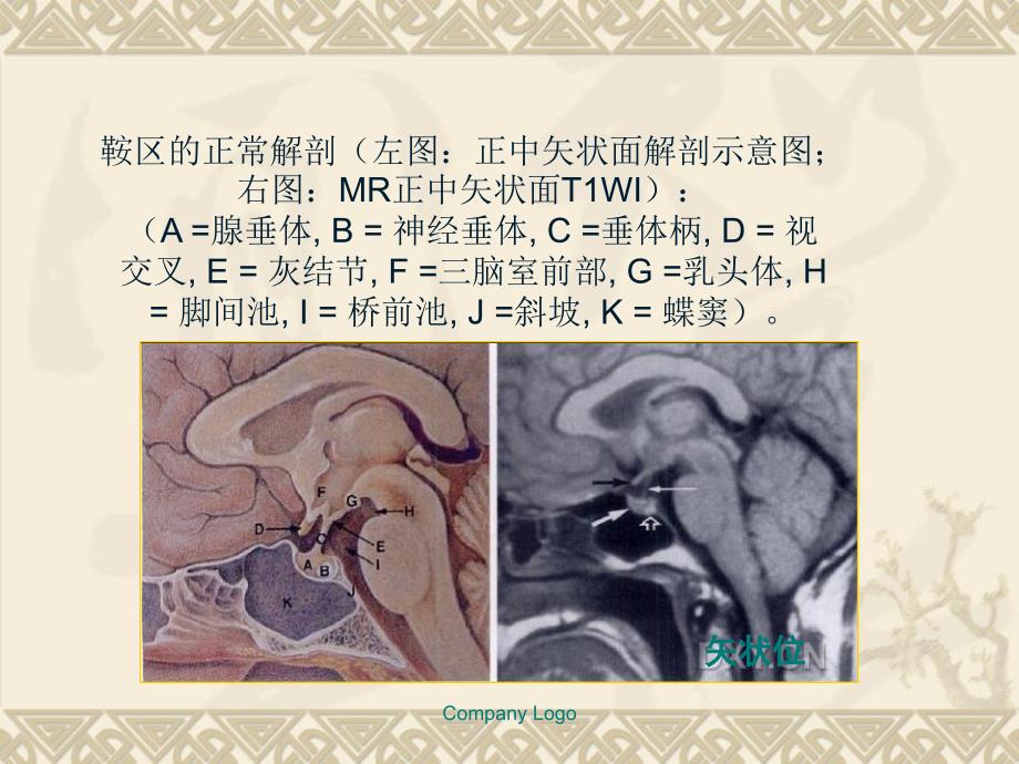 垂体的基础知识ppt课件_第3页