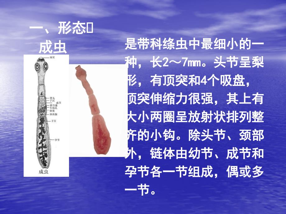 第四节棘球绦虫其发育过程中需要哺乳类动物分别作为终宿_第4页