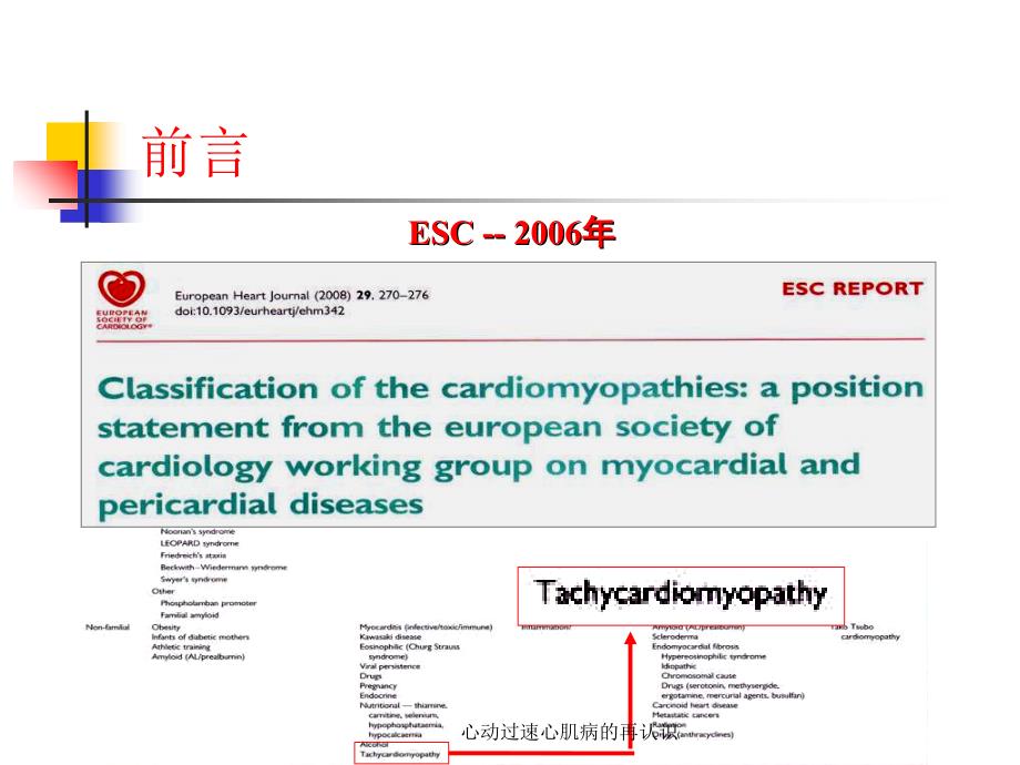 心动过速心肌病的再认识课件_第3页