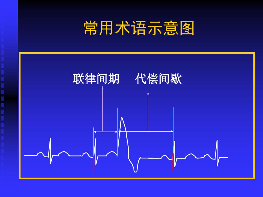 第五节心律失常_第4页