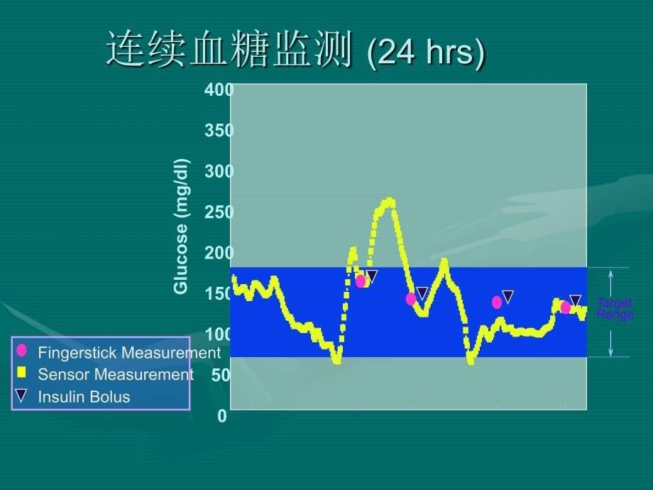 动态血糖监测系统_第5页