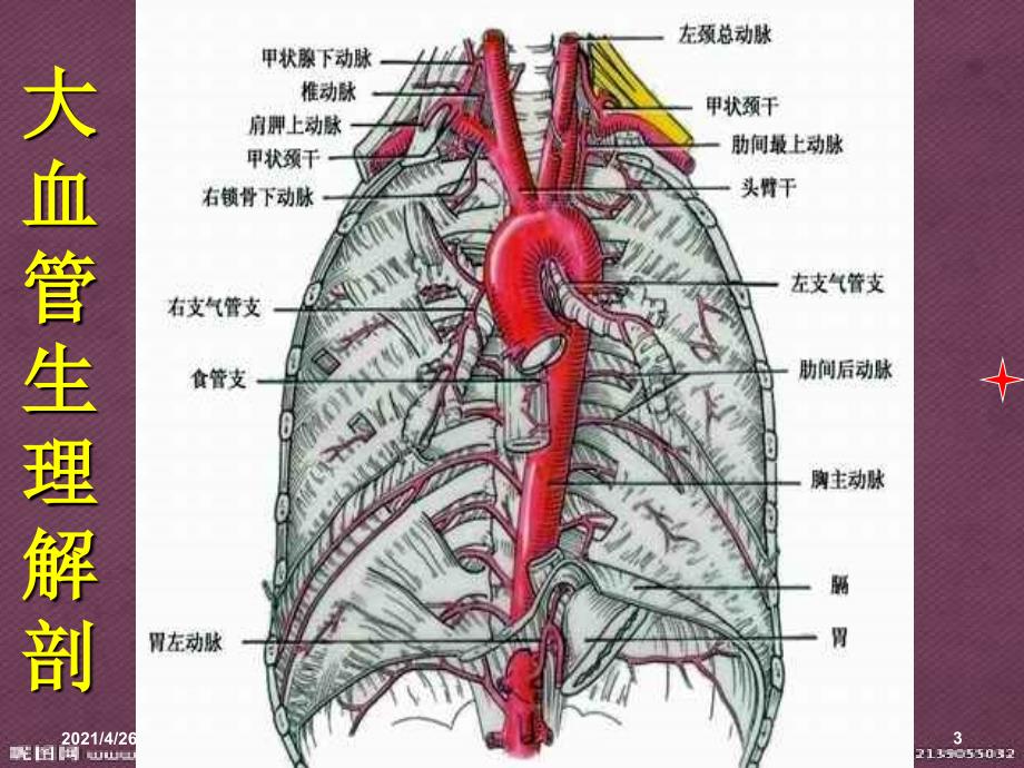 主动脉夹层护理_第3页