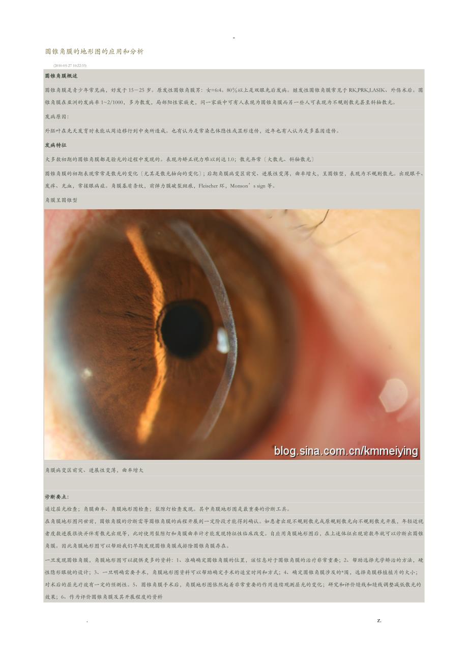 圆锥角膜的地形图的应用和分析梅颖_第1页