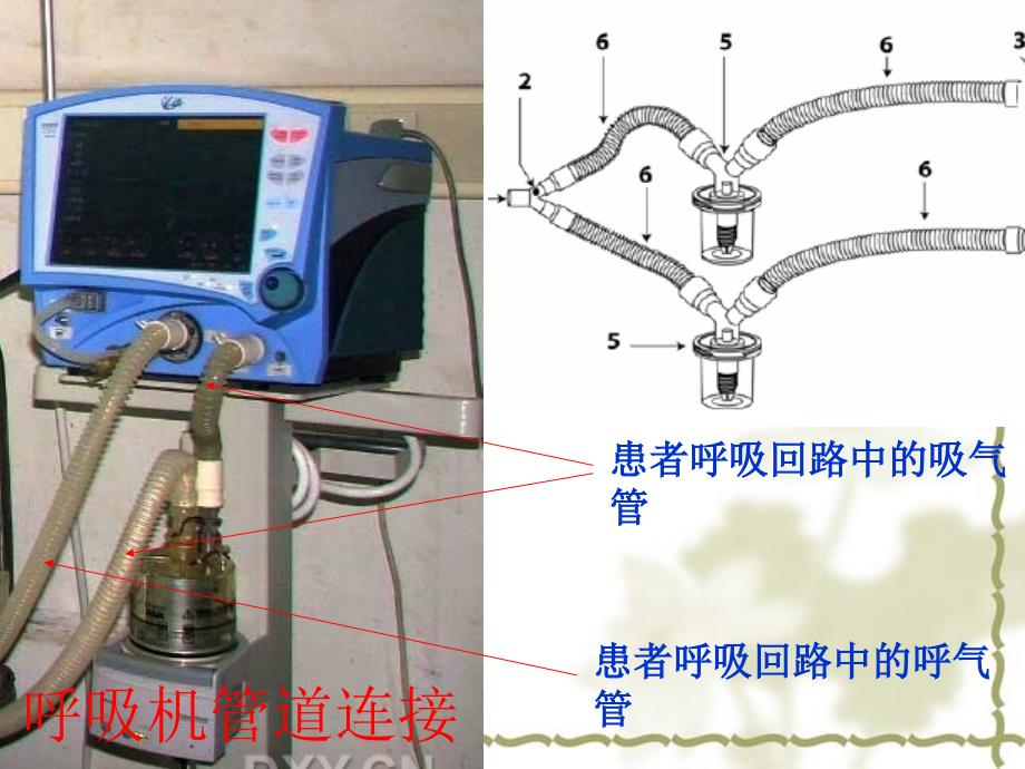 如何使用呼吸机课件_第3页